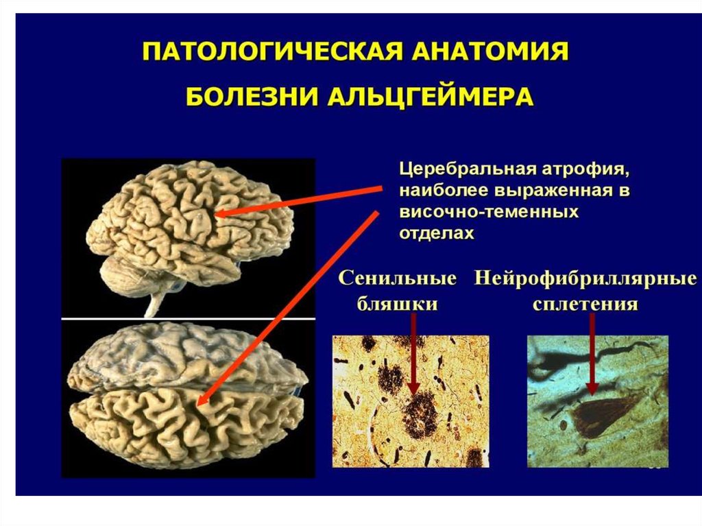 Что такое когнитивные функции мозга. Когнитивные функции мозга. Когнитивные функции картинки. Когнитивная функция для презентации. Как восстановить когнитивные функции мозга.