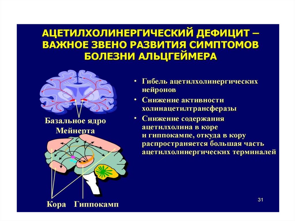 Альцгеймера протокол