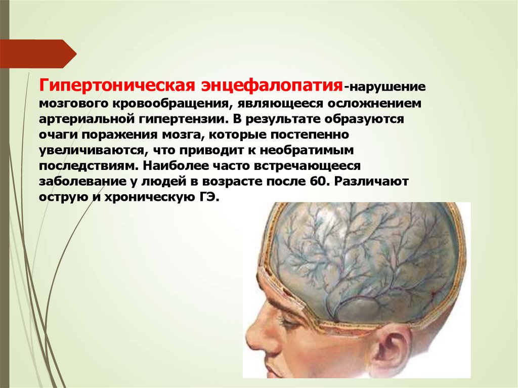 Признаки энцефалопатии мозга. 167.4 Гипертензивная энцефалопатия что это такое. Энцефалопатия головного мозга что это такое. Острая энцефалопатия головного мозга. Острая гипертоническая энцефалопатия.