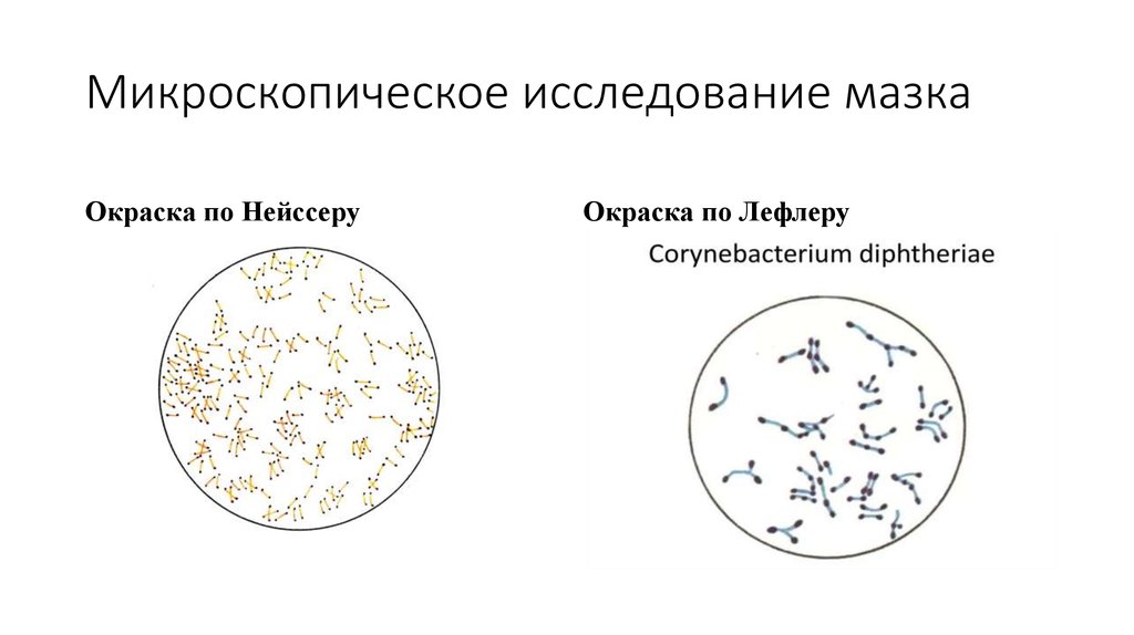 Микроскопическое исследование мазка