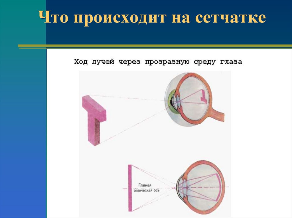 Для получения четкого изображения на сетчатке