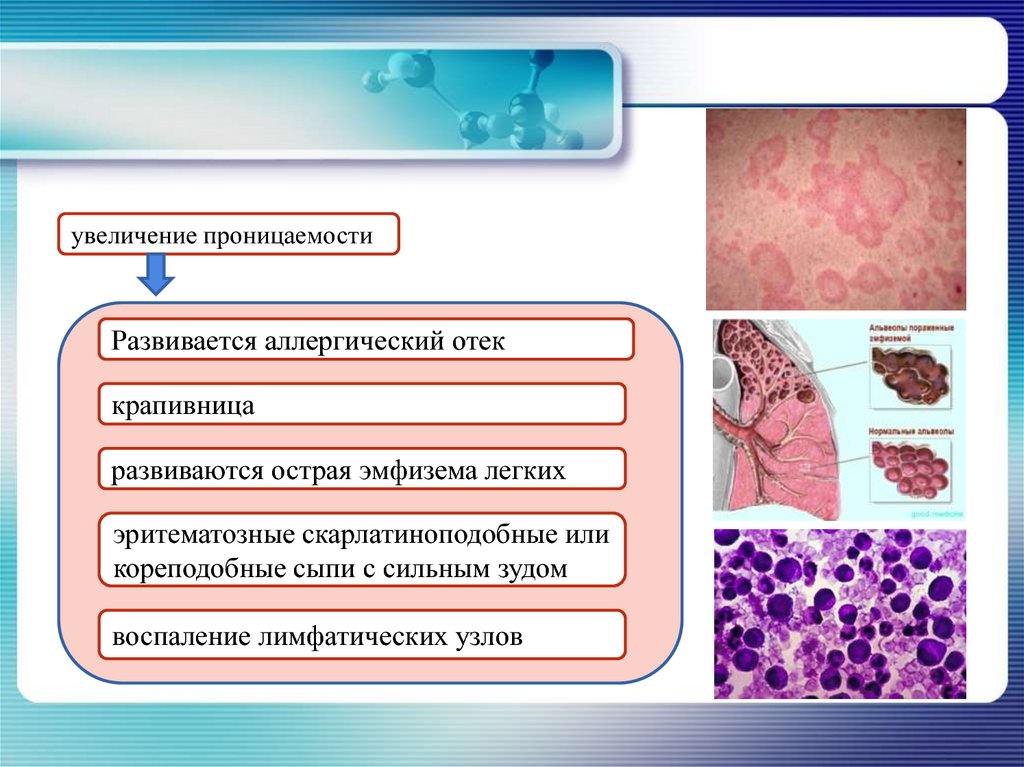 Сывороточная болезнь презентация