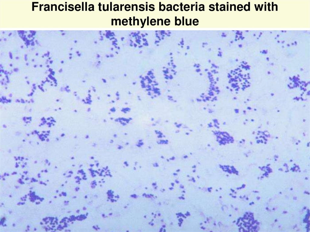 Francisella tularensis bacteria stained with methylene blue