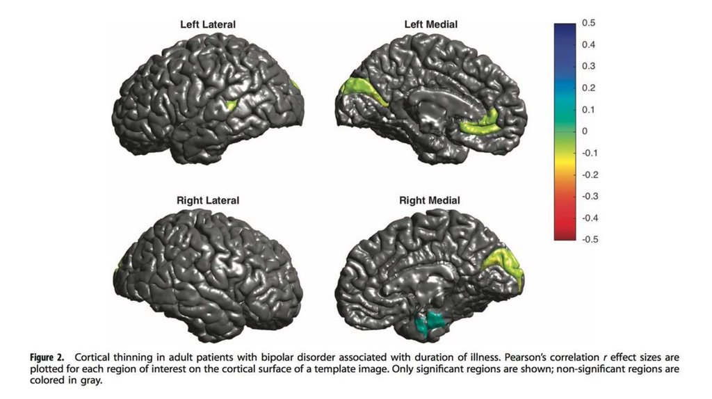 Биполярное расстройство мозг. Мозг при биполярном расстройстве. Изменения мозга при биполярном расстройстве. Мозг человека с биполярным расстройством.