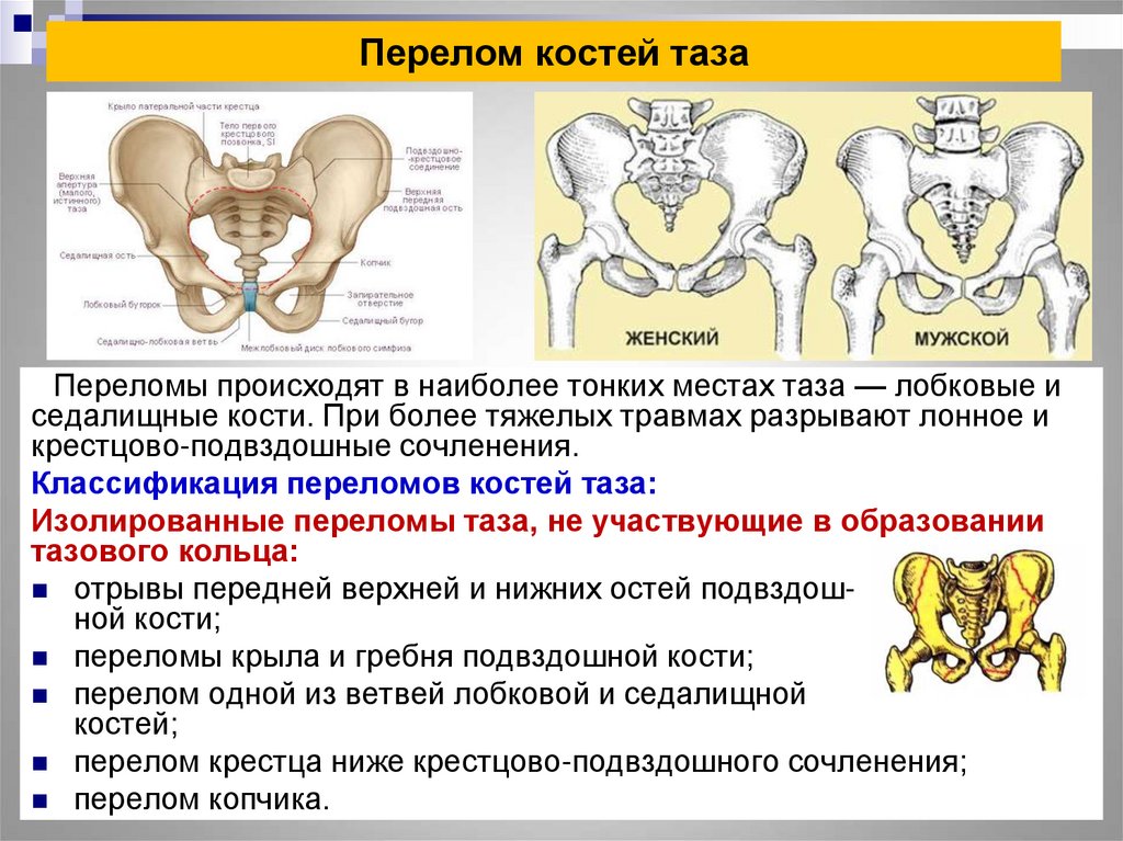 Изменения костей таза. Перелом лонной кости классификация. Перелом лонной и седалищной кости. При переломе лонных костей таза. Перелом нижней ветви лонной кости.