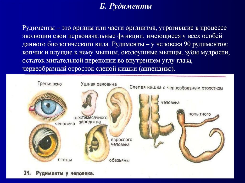 Рудименты человека. Рудименты это органы утратившие. Рудименты человека относятся к.