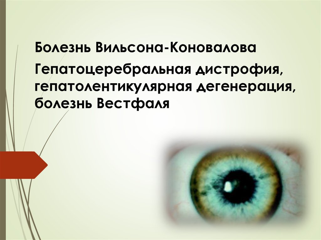 Болезнь вильсона. Болезнь Вильсона — Вестфаля — Коновалова. Гепато-церебральная дистрофия Вильсона-Коновалова. Вильсона Коновалова болезнь мкб 10. Болезнь Вильсона-Коновалова очаг поражения.