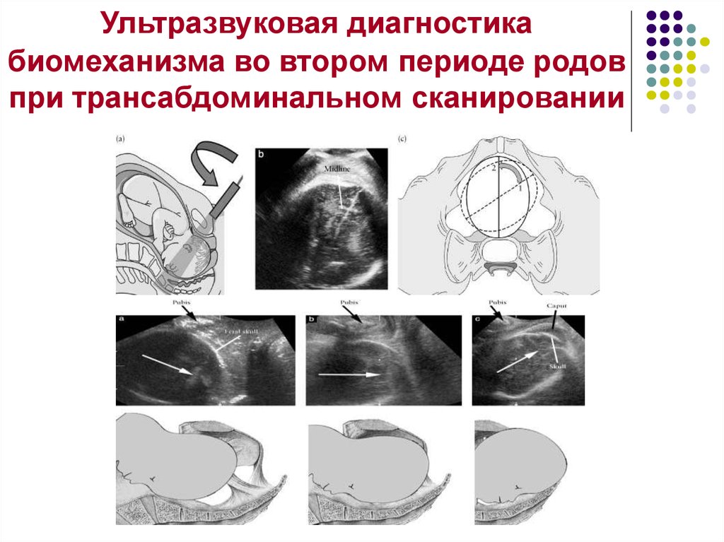 Материнский травматизм презентация