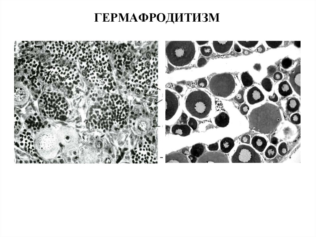 ГЕРМАФРОДИТИЗМ