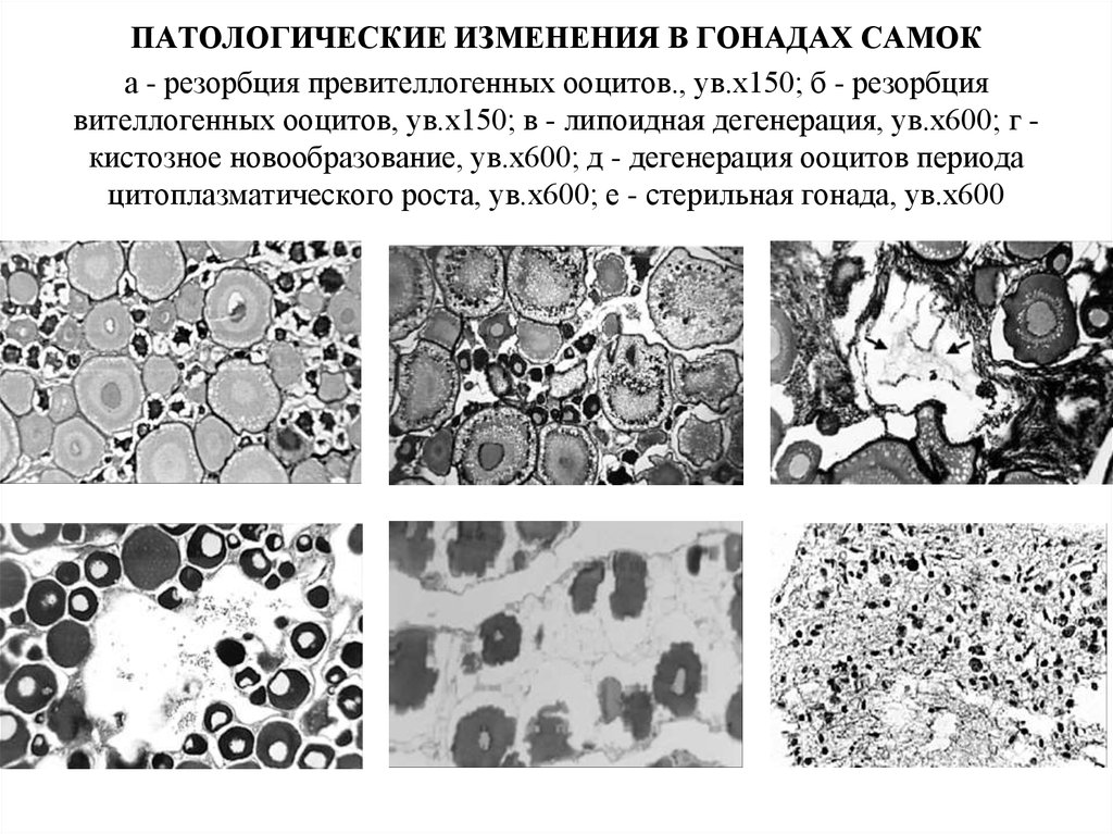 Патологические изменения. Вителлогенные ооциты. Липоидная дегенерация это. Липоидная дегенерация лимфоузлов что это. Какие патологические изменения обусловливают появление пузырька:.