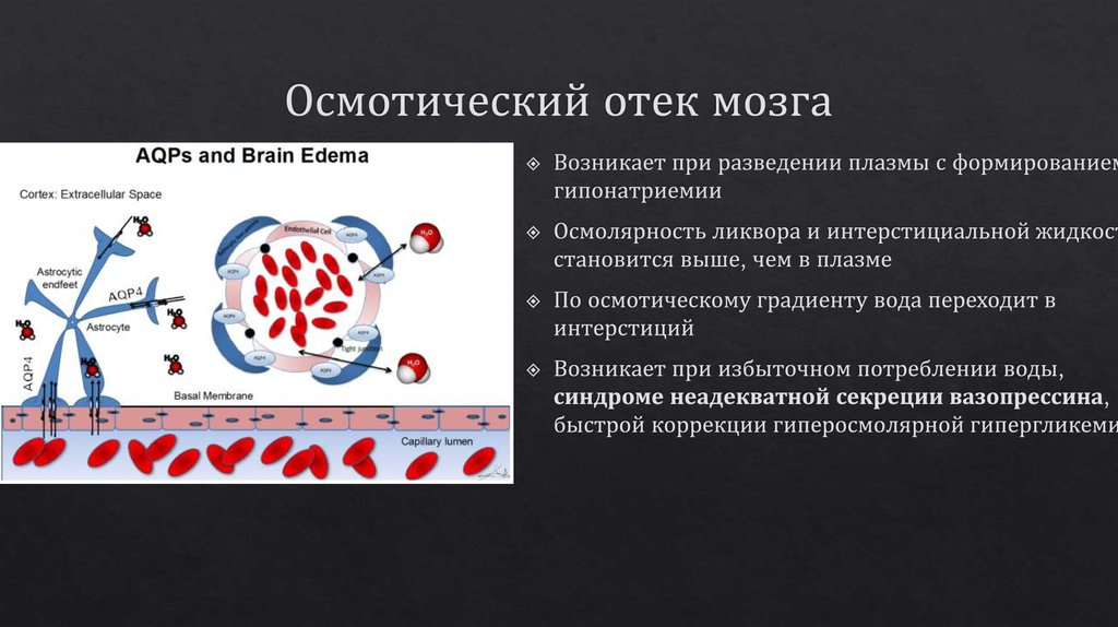 Неадекватная секреция антидиуретического гормона