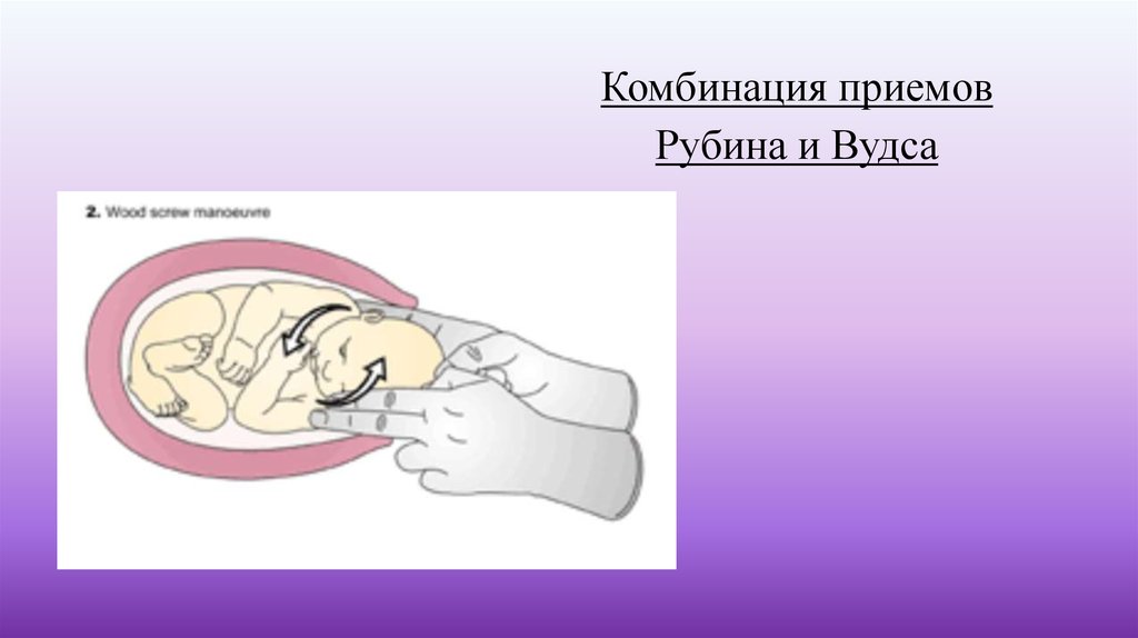 Во втором периоде родов происходит