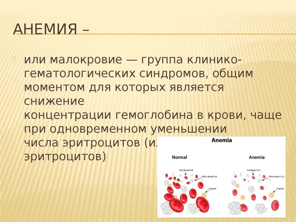 Что за болезнь анемия. Анемия презентация. Анемия это простыми словами.