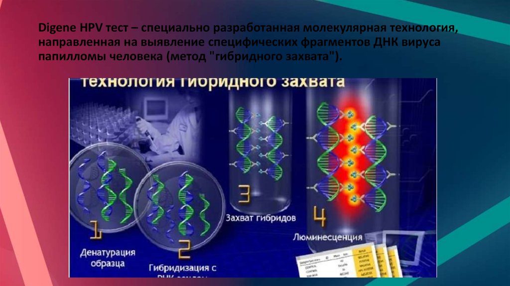 Вирус фрагмент днк. Digene тест на ВПЧ что это. Дайджен тест. Метод гибридного захвата. Digene Test расшифровка.