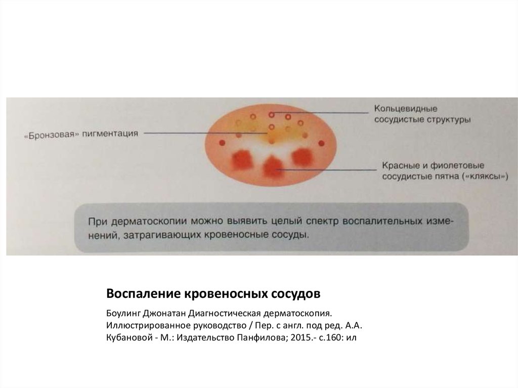 Дерматоскопическое заключение образец