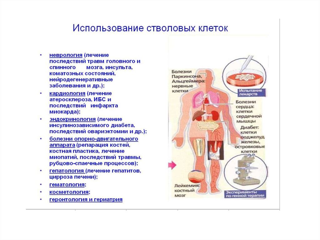 Стволовые клетки применение. Использование стволовых клеток. Использование стволовых клеток в медицине. Стволовые клетки использование. Применение стволовых клеток в медицине – базовые принципы..