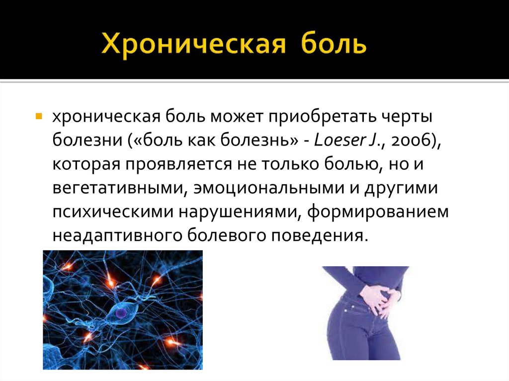 Презентация синдром хронической боли