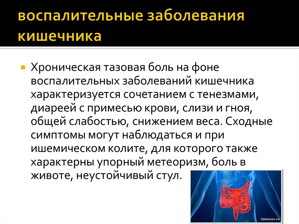 Кишечные болезни. Воспалительные заболевания кишечника. Воспаление заболеваний кишечника. Воспалительное заболевание кишечника (ВЗК). Клинические проявления заболеваний кишечника.