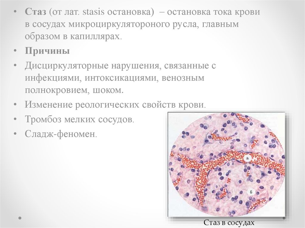 Стаз это