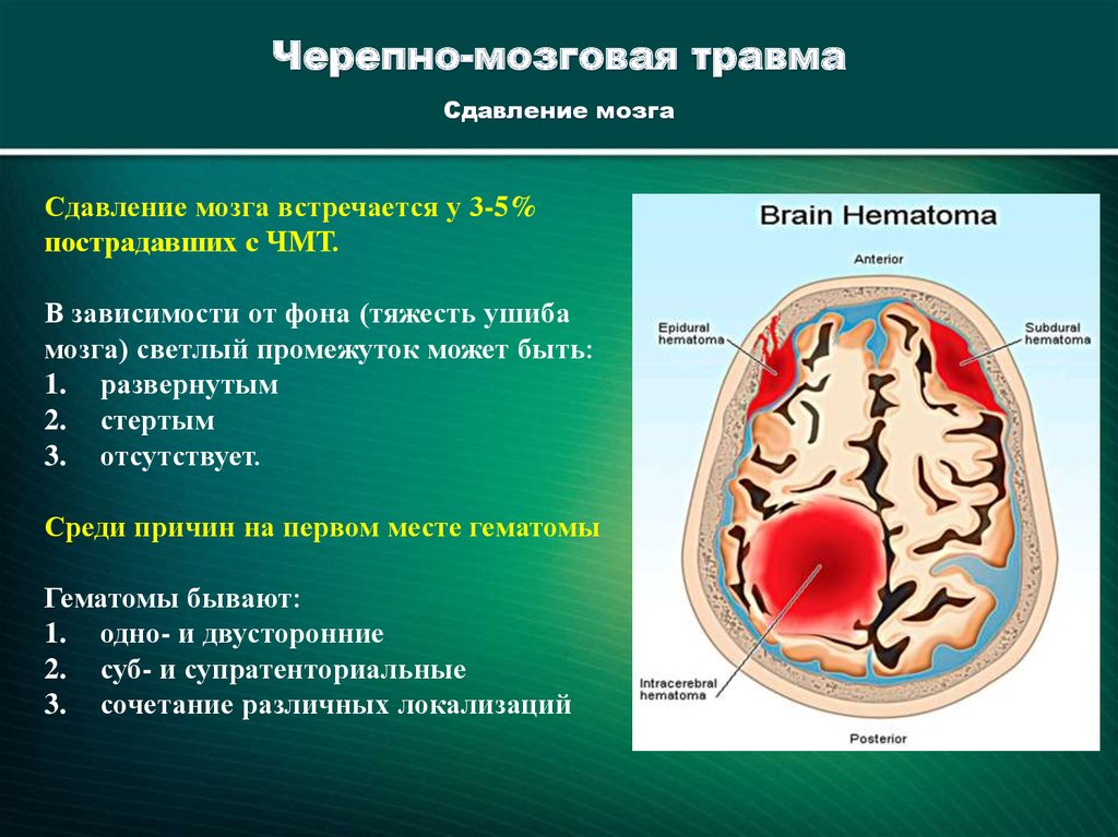 Черепно мозговая травма код. Классификация черепно-мозговой травмы. Оценка тяжести черепно мозговой травмы критерии. Оценка тяжести пострадавшего при травме головы. Критерии степеней тяжести черепно-мозговой травмы.