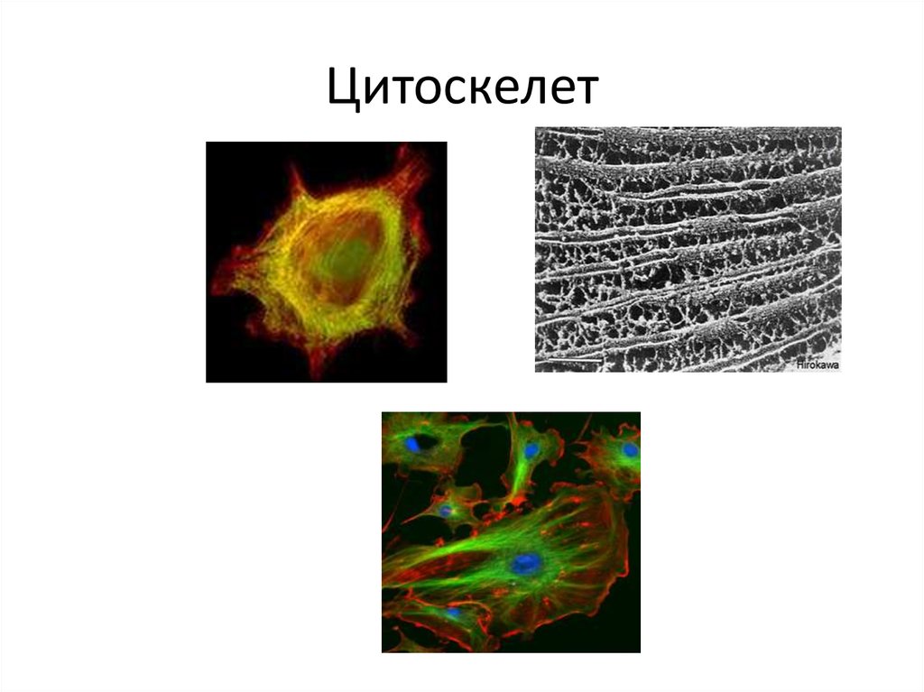 Цитоскелет клетки какой органоид
