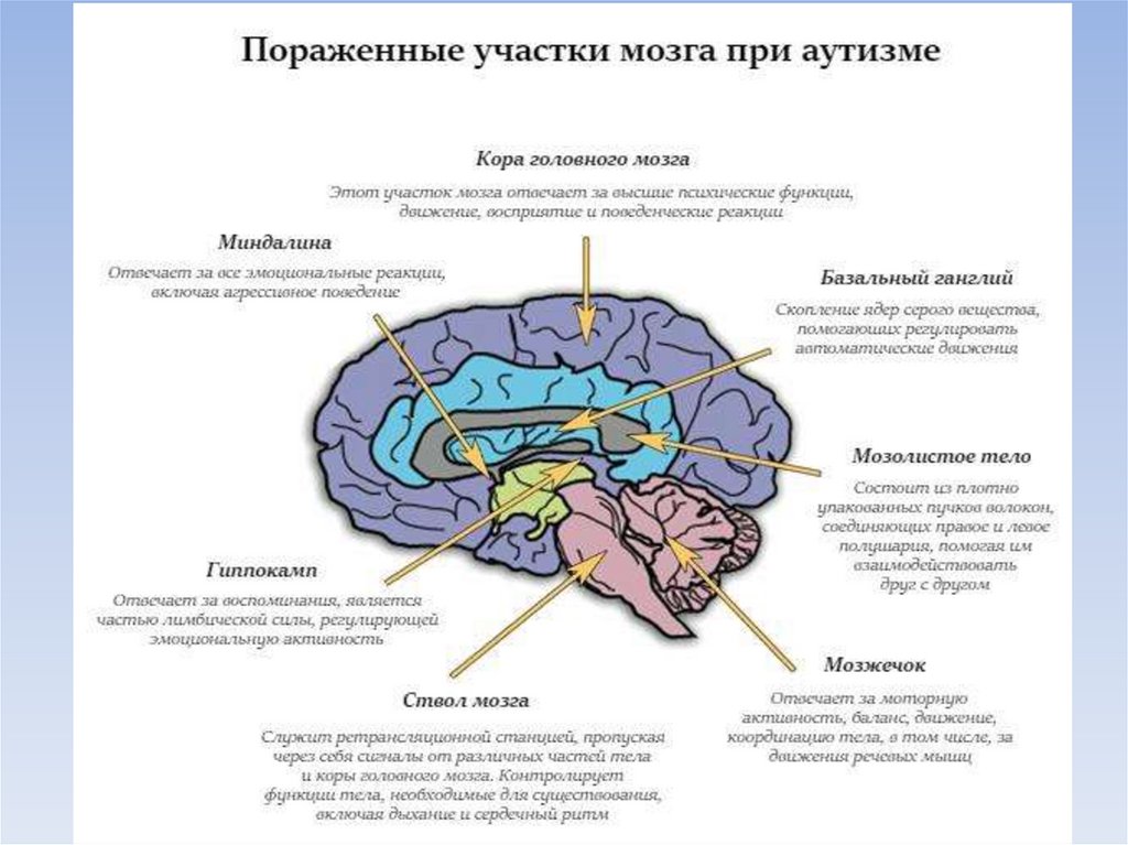 Органические изменения головного. Поражение зон мозга при ДЦП. Мозг аутиста. Мозг при аутизме. Головной мозг при аутизме.