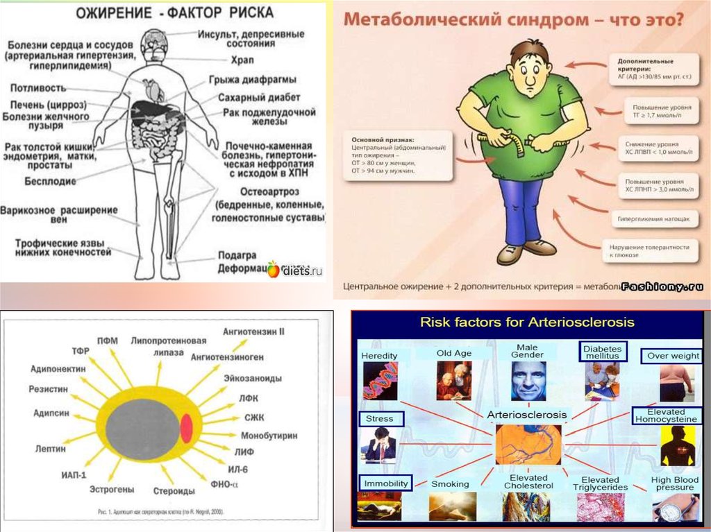 Риск ожирения. Факторы риска ожирения. Факторы риска при ожирении. Ожирение как фактор риска. Факторы риска ожирения и метаболического синдрома..