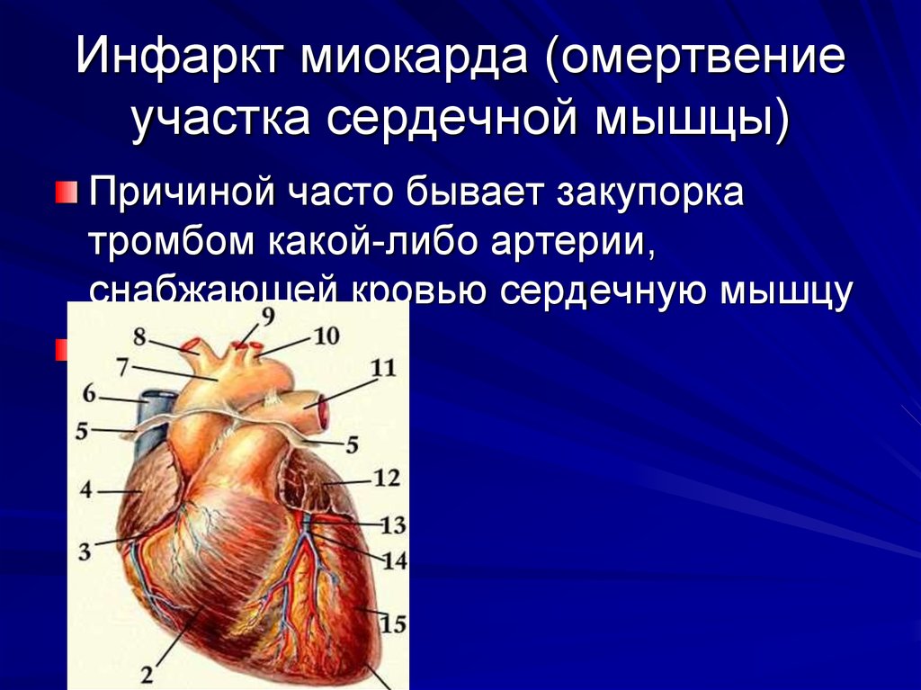 Некроз участка сердечной мышцы