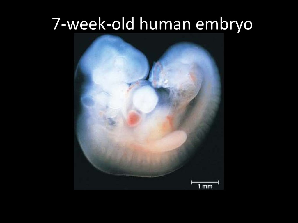 7-week-old human embryo