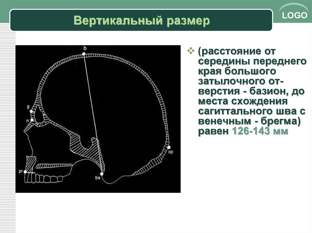 Вертикальный размер 6. Вертикальный размер. Вертикальный диаметр. Вертикальный размер черепа. Вертикальный размер головки.