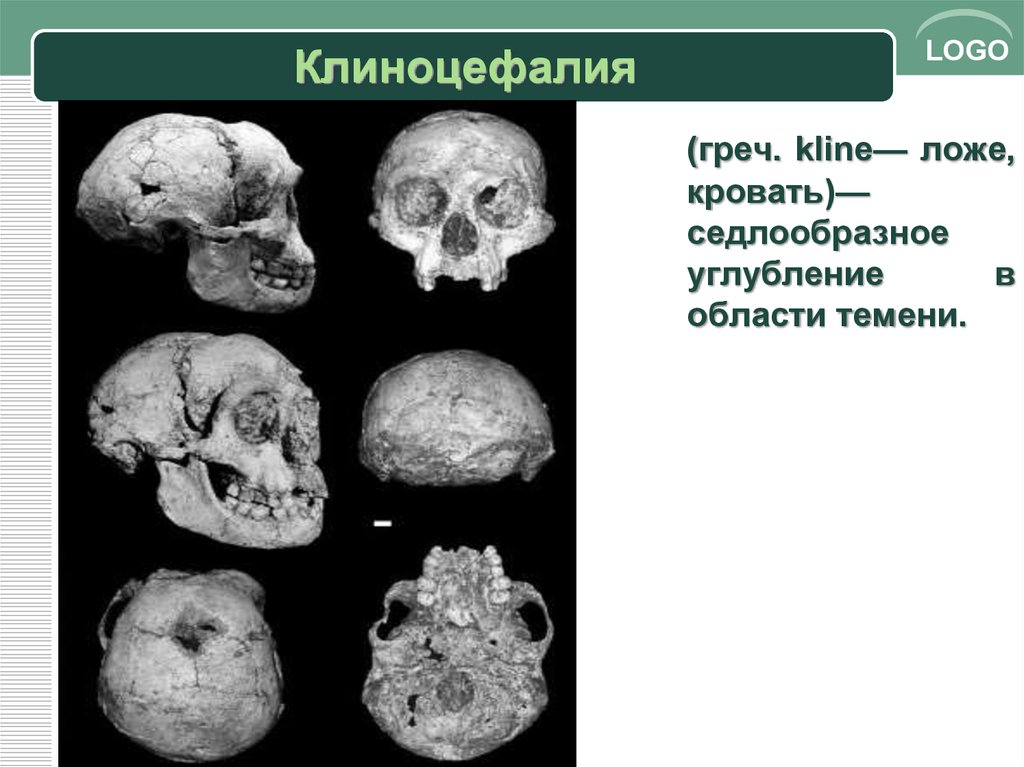 Развитие черепа