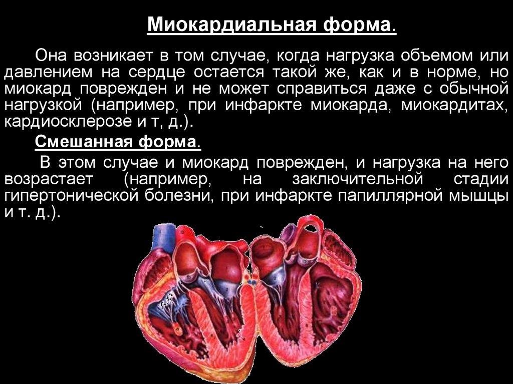 Миокардиальная сердечная недостаточность. Миокардиальная форма сердечной недостаточности. Причины миокардиальной сердечной недостаточности. Миокардиальный мостик клинические рекомендации. Причины миокардиальной формы сердечной недостаточности.
