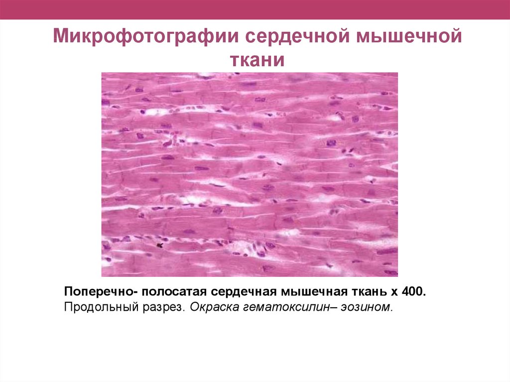 Изображение поперечно полосатой мышечной ткани
