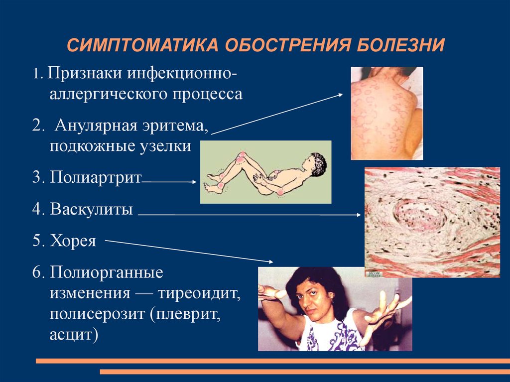 Ревматизм картинки для презентации