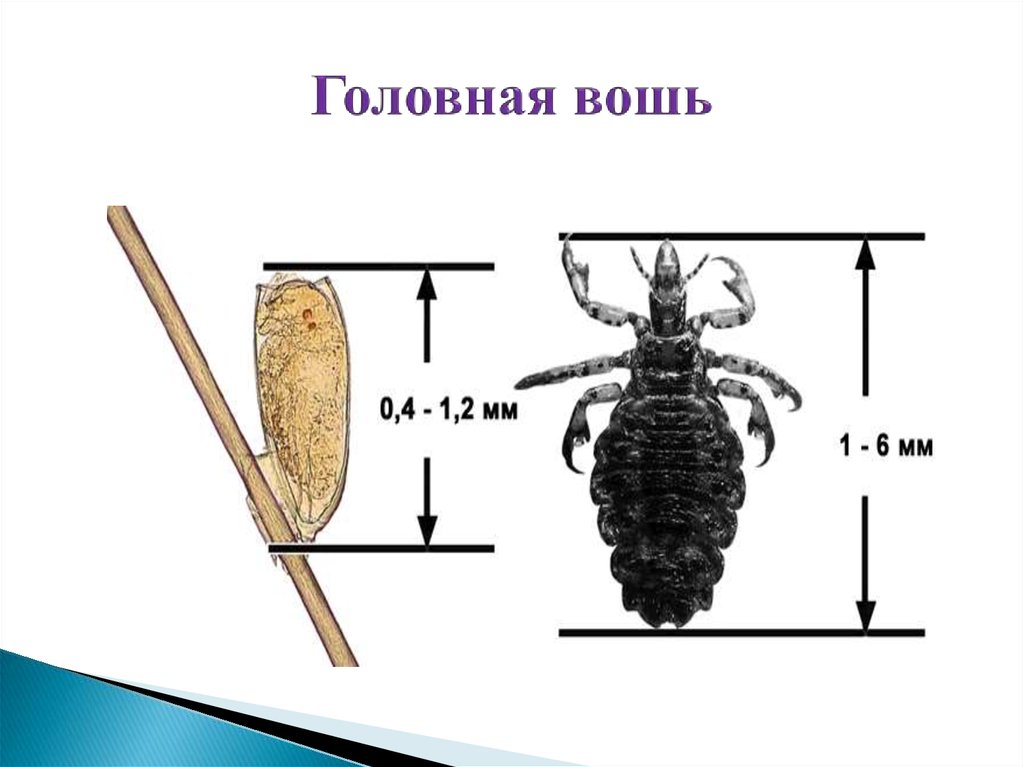 Яйцо головной вши рисунок