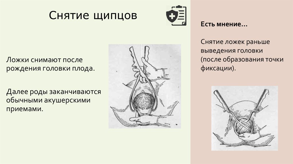 Вакуум экстракция плода