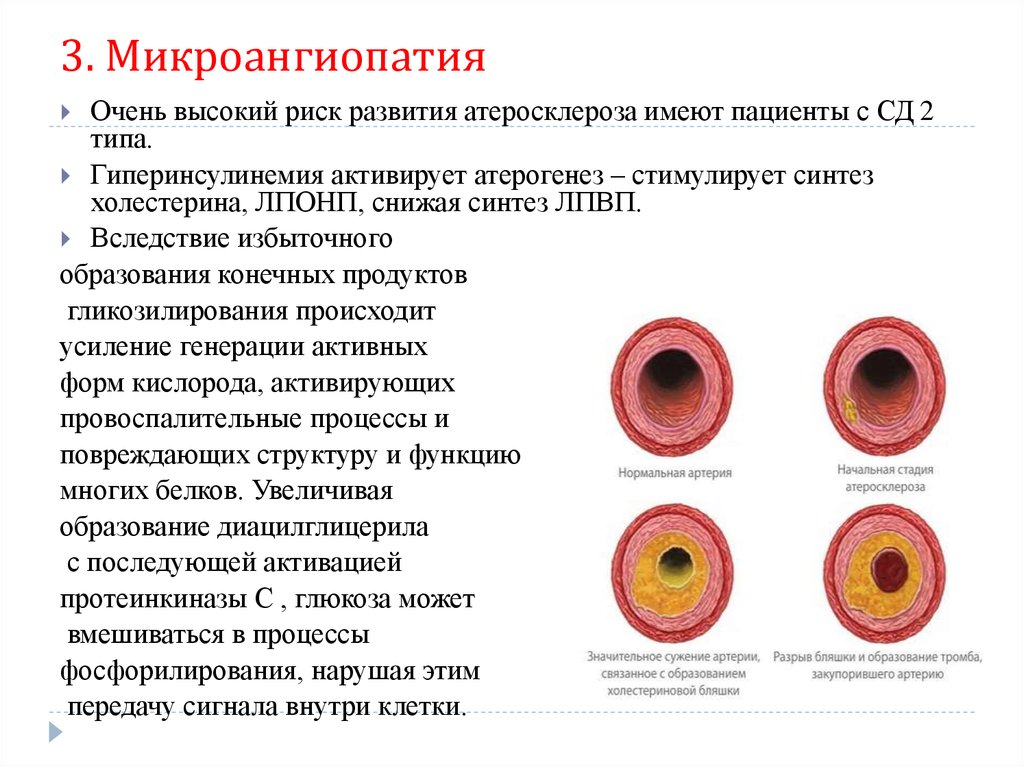 Картина церебральной микроангиопатии что это