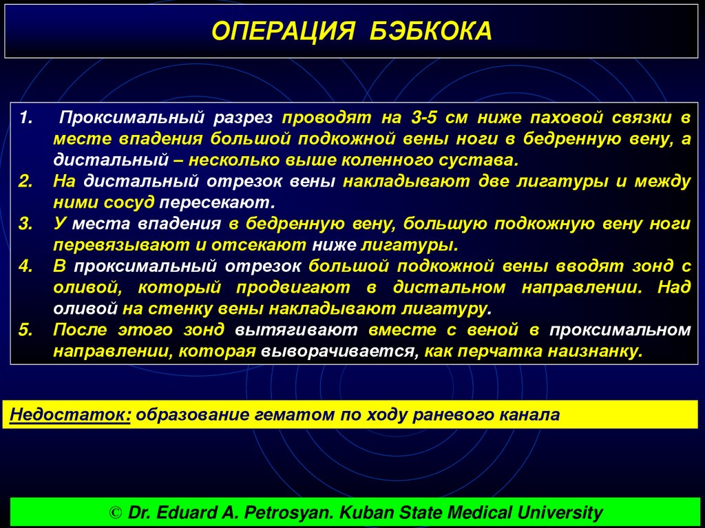 Операции заключается в том что. Этапы операции Бэбкока. Операция Бэбкока при варикозном расширении. Операция Бэбкока топографическая анатомия.