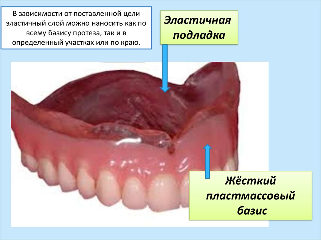 Реферат: Базисные пластмассы для съемного протезирования