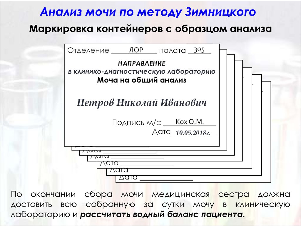 Алгоритм сбора мочи по зимницкому