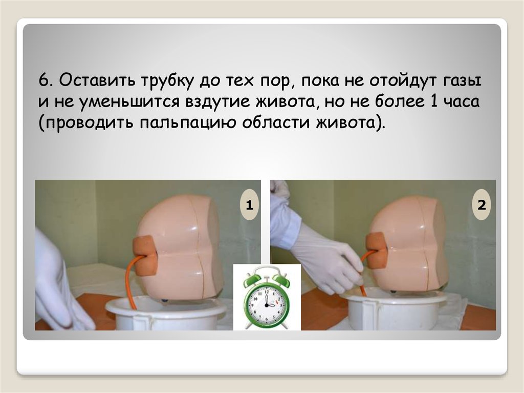 Постановка газоотводной трубки. Оснащение, необходимое для постановки газоотводной трубки. Газоотводная трубка алгоритм. Введение газоотводной трубки.