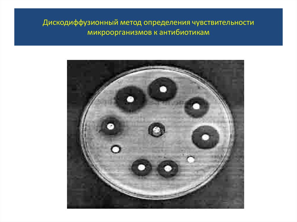 Определение чувствительности к антибиотикам. Чувствительность бактерий к антибиотикам. Набор антибиотиков для определения чувствительности. Диски для определения устойчивости микроорганизмов к антибиотикам. Кассетный метод определения чувствительности микробиология.