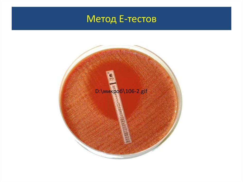 Метод е. E Test микробиология. Метод е тестов микробиология. Е-тесты для определения чувствительности. Е-тест антибиотики микробиология.