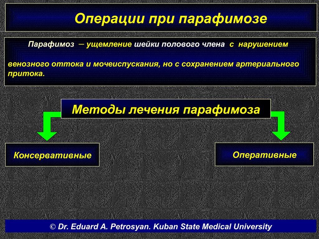 Парафимоз симптомы