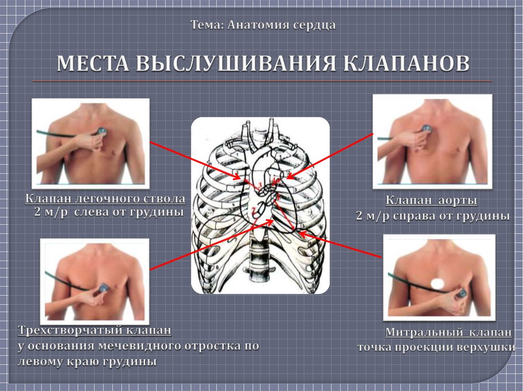 Проекция клапанов. Места выслушивания клапанов сердца анатомия. Анатомические ориентиры для выслушивания. Проекция клапанов сердца и места их выслушивания. Прибор для выслушивания тонов сердца.