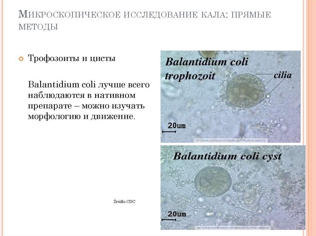 Микроскопия анализа кала