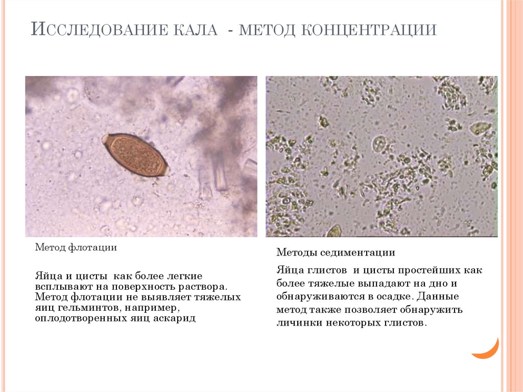 Кал стерилен. Микроскопия кала яйца гельминтов. Методы исследование кала на яйца гельминтов. Яйца остриц микроскопия. Яйца гельминтов метод като микроскопия.
