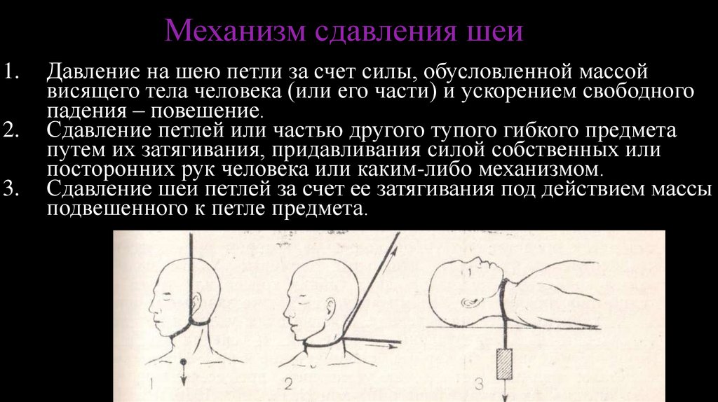 Травматическая асфиксия презентация