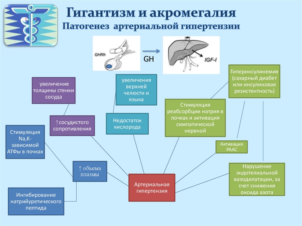 Гигантизм акромегалия презентация