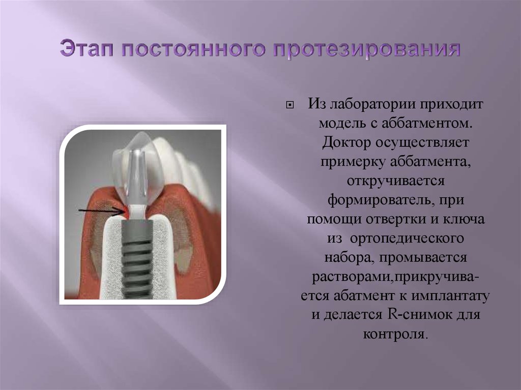 Социальный протез. Социальное протезирование в психологии это. Решение конкретных проблем с помощью социального протезирования. Характеристика метода «социальное протезирование».